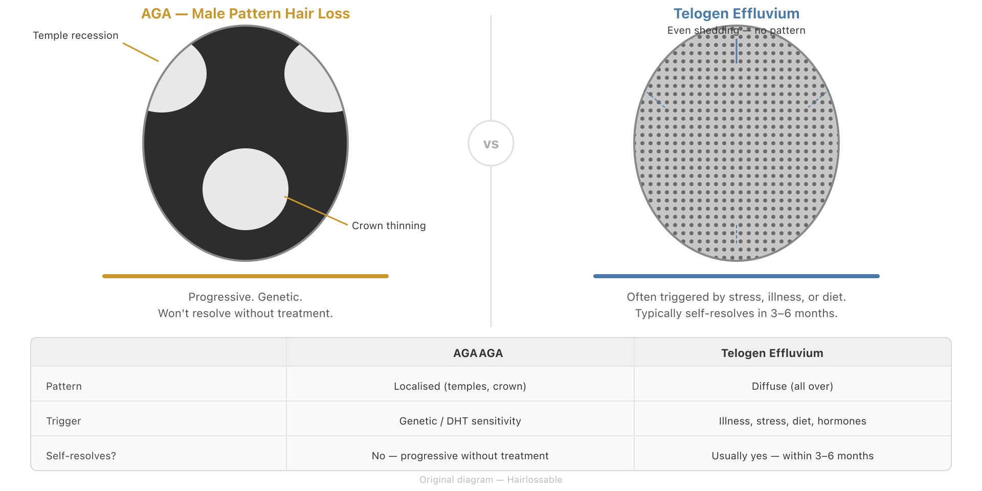 Comparison of androgenetic alopecia pattern hair loss versus telogen effluvium diffuse shedding