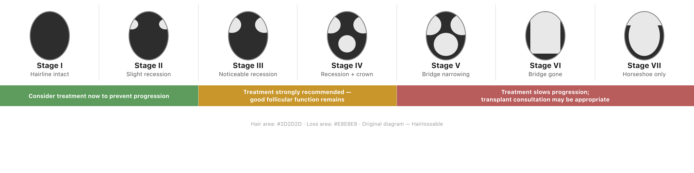 Norwood scale diagram showing seven stages of male pattern hair loss from Stage I through Stage VII