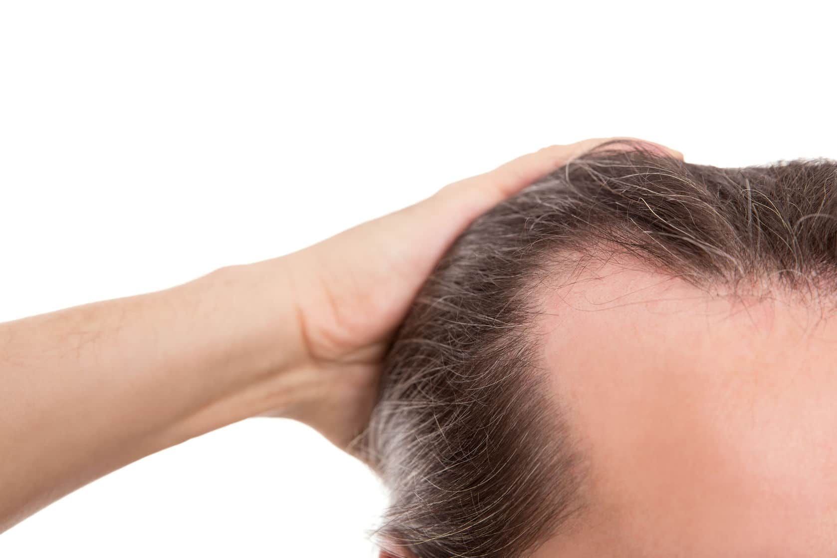 PRP Injection Hair Loss Treatment: Is it the right treatment to use?