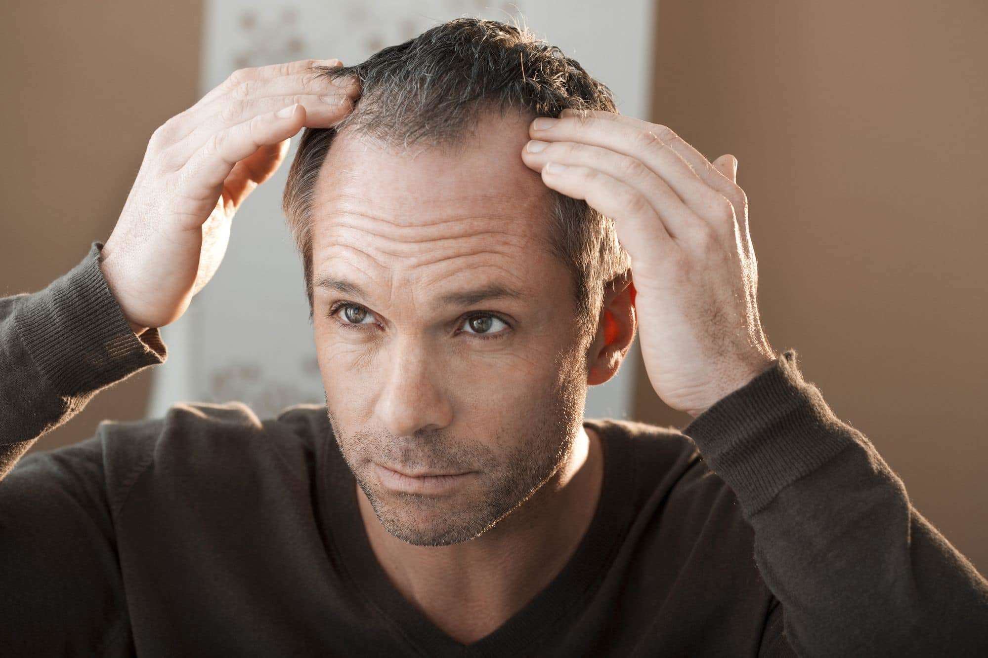 How Much Hair Loss is Normal? | Hairlossable.com